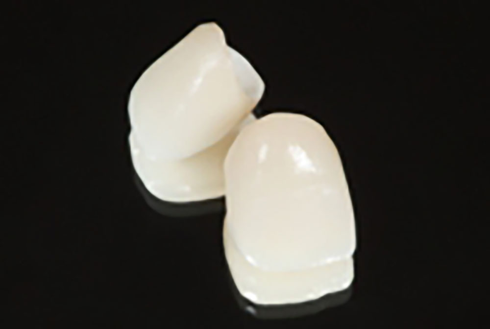 ハイブリッドセラミック（クラウン）