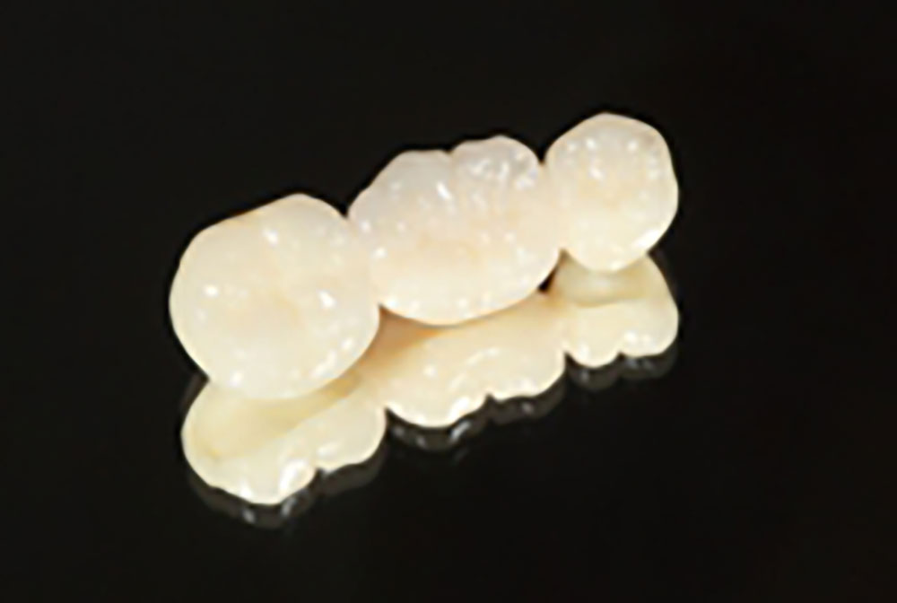 ジルコニア（クラウン）