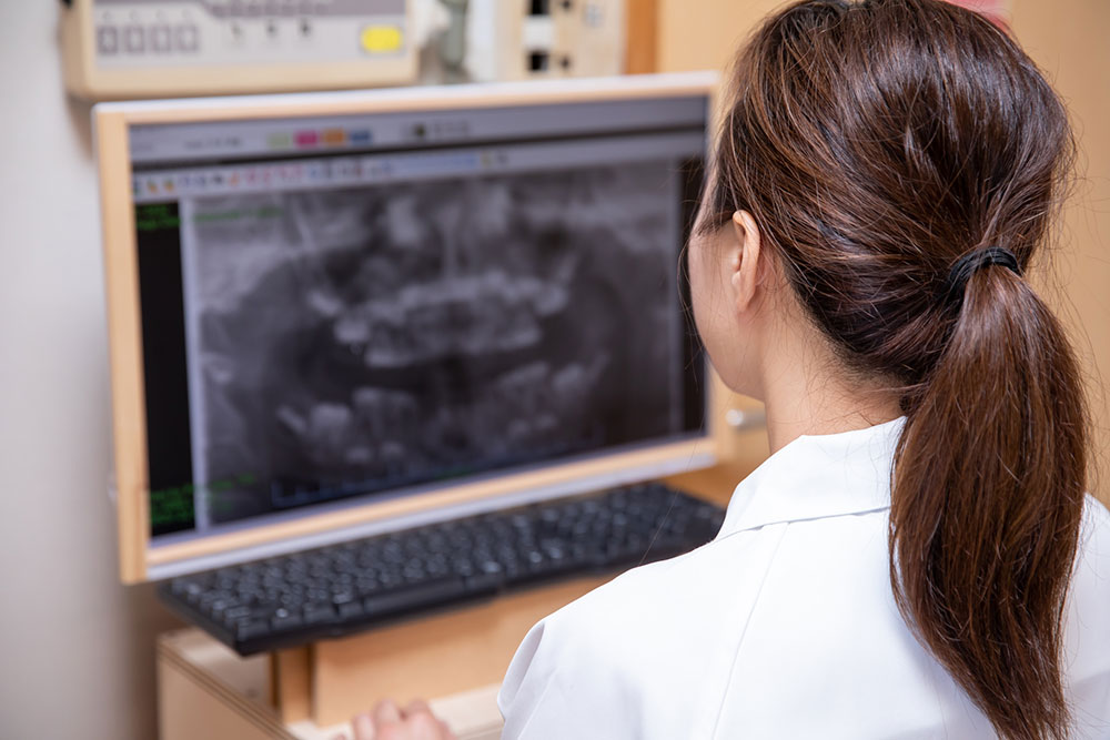 CT撮影画像から治療をシミュレート